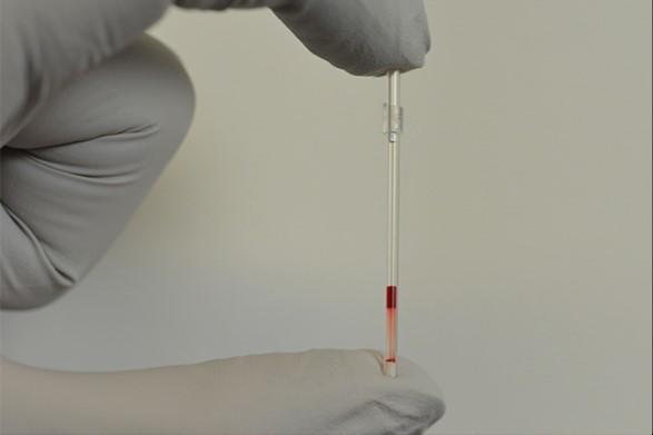 Figure17-sickle-cell